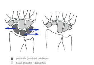 Deze folder geeft informatie over de revalidatie na een proximale rij carpectomie (=verwijderen eerste rij van 3 handwortelbeentjes uit het polsgewricht) Na de operatie door de (plastisch) chirurg