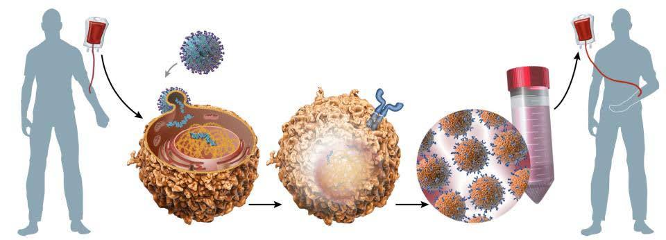 CAR T cellen: productie Chemo/radiotherapie: