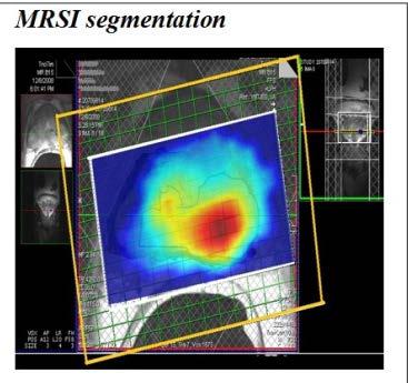 processing - Medical imaging