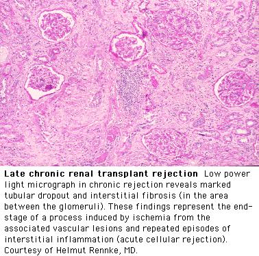 weefselovereenkomst) toegenomen kans op late acute afstoting Toekomst: cyclosporine / tacrolimus laat na transplantatie vervangen door andere middelen