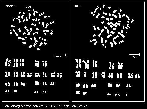 Met de computer of handmatig worden de afgebeelde chromosomen vervolgens gerangschikt naar grootte.