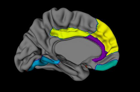 Left Effect fitness op globale breinvolumes Geen significante verschillen tussen de groepen behalve: Trend-level significant Hippocampus effect En nu?