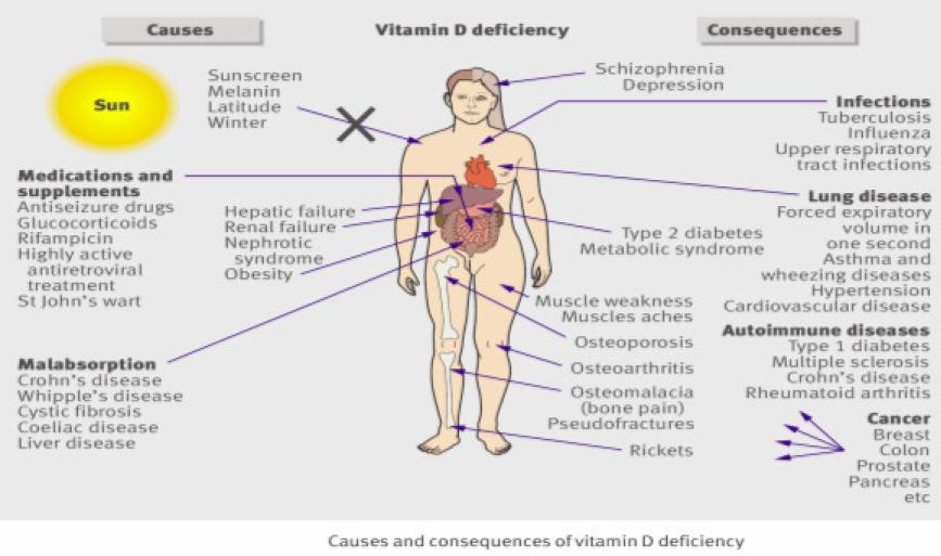 Hogere vitamine D = minder cardiovasculaire aandoeningen Serum 25 (OH) D-spiegel lager dan 30ng/ml heeft een significante associatie met cardiovasculaire aandoeningen (hypertensie, coronaire