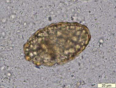 5.3. Commentaar op de resultaten van de enquête 006/ parasitologie Het staal P/5499 bevatte onbevruchte eieren van Ascaris lumbricoides.