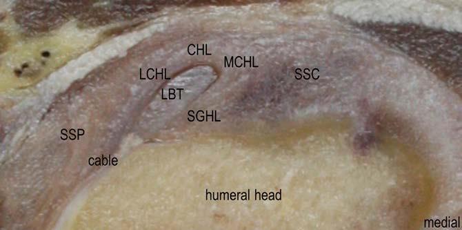 Over SGHL & CHL (RC interval)