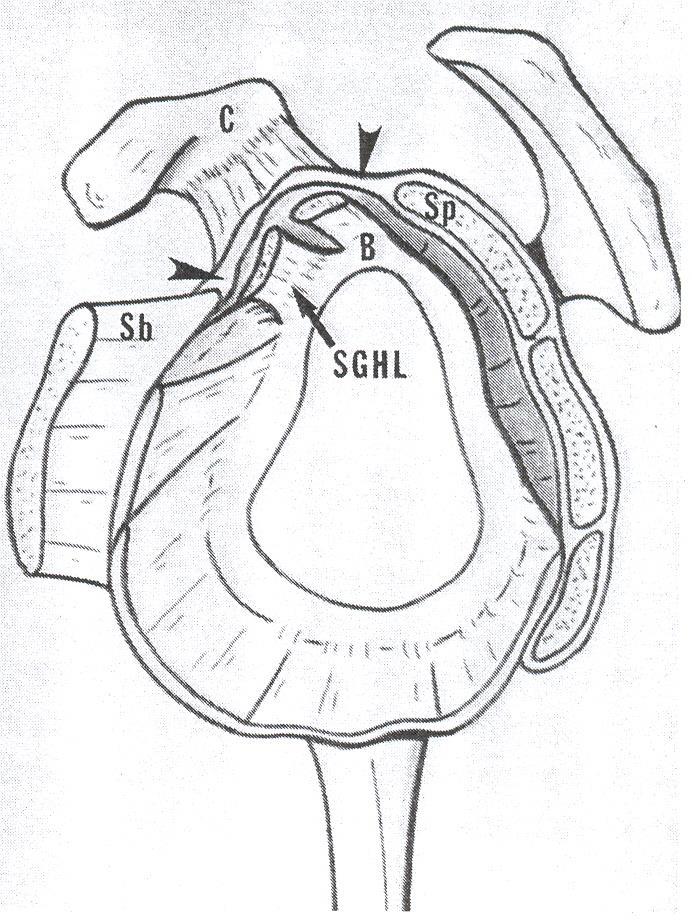 Ventrale RC