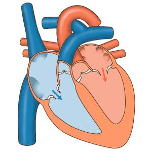 Voeding * Pneumonitis *