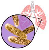 Bacterie dringt luchtwegen binnen () 5% Nestelt zich in de longen INFECTIE 5% Eliminatie door eigen lichaam ZIEKTE % (5)