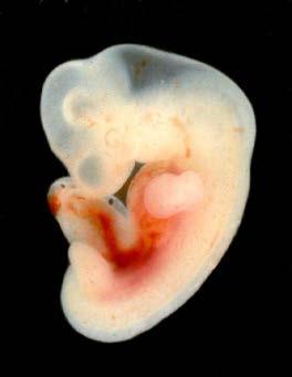 Klein als embryo, verhoogde kans op: Complicaties tijdens