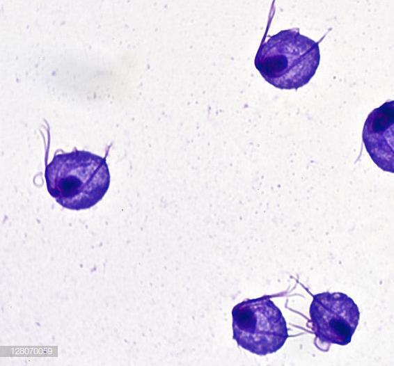 Trichomonas vaginalis Algemeen: - parasitair levende protozo - sexueel overdraagbaar -