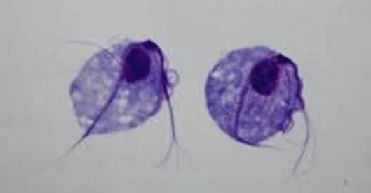 Trichomonas vaginalis Diagnostiek: - microscopie (slechts 60% gevoeligheid) - NAAT (PCR)