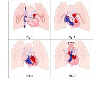 2. DE WERKING VAN HET HART Het hart is een holle spier in het midden van de borstkas en maakt deel uit van de circulatie.