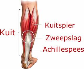 Wat is een zweepslag? Een zweepslag is een spierletsel.