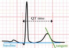 Take home messages - Denk aan de juiste manier van bepalen van het QT interval en aan correctie voor de hartfrequentie - Belangrijke oorzaak: elektrolytstoornissen - Veel gebruikte