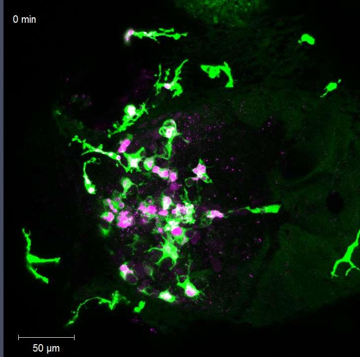 Microglia in zieke brein microglia neuronen Ziek hersen weefsel -> meer microglia,