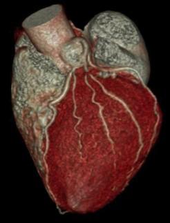CT-scan van het hart Onderzoek op de afdeling Beeldvorming U bent door uw behandelend arts doorverwezen naar de afdeling Beeldvorming voor een CT-scan van uw hart.