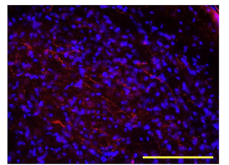 Nucleus trigeminus van een rat Rood = geknipt SNAP-25 Blauw = kleur om celkernen te