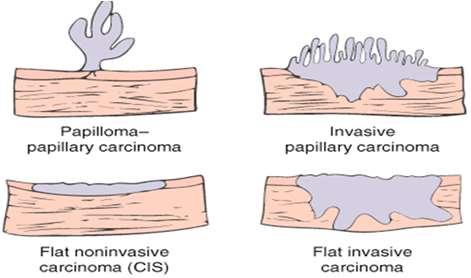 Niet-invasieve blaastumoren ptis en pta Zolang de tumor niet invadeert doorheen de basale membraan: niet-invasief /1 of /2 Niet-invasief Invasief pta pt1a bestaat niet voor de blaas!
