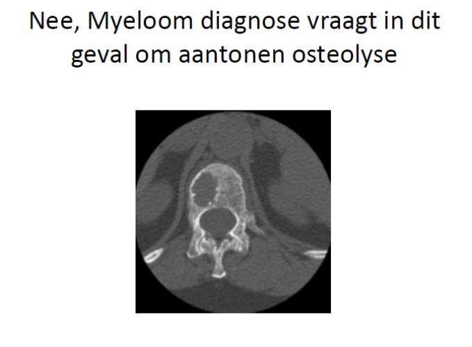 Beeldvorming MRI skelet status Low dose whole