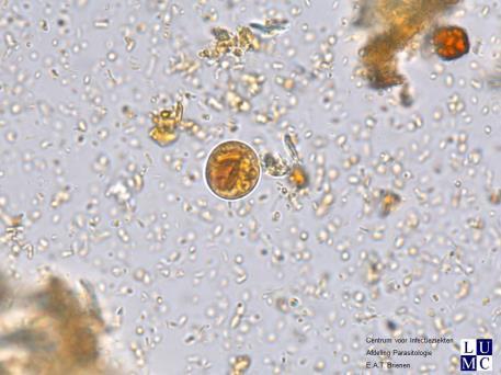 histolytica/dispar niet opgegeven of E. histolytica gerapporteerd overige protozoaire species niet betrokken bij performance score Monster C - Ascaris sp.