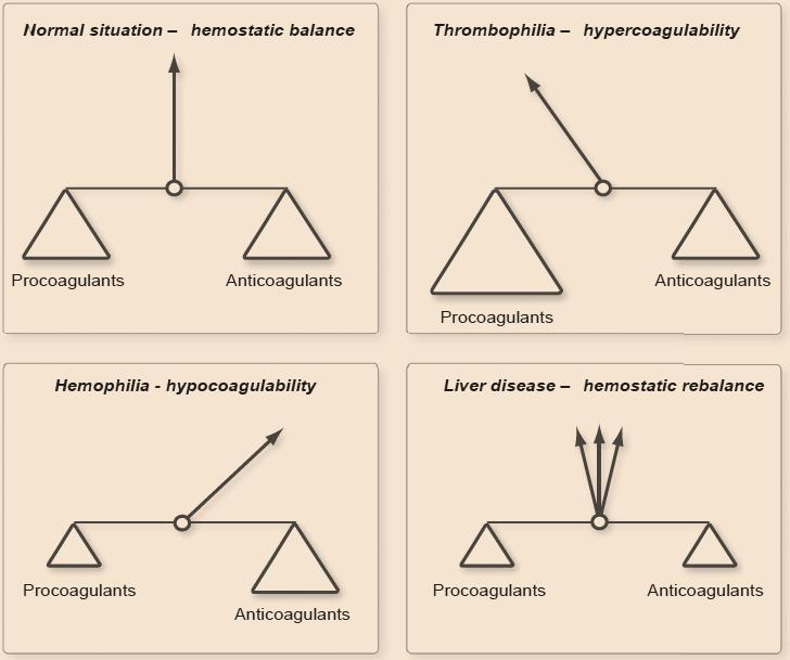 Behandeling van acuut leverfalen Geen stollingscorrectie, tenzij. Lisman T et al.