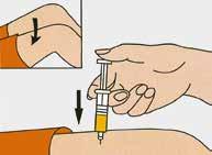 Injecteer de oplossing onder de huid of in een spier. 5. Leg de bewusteloze patiënt op de zij om verstikking te voorkomen. 6.