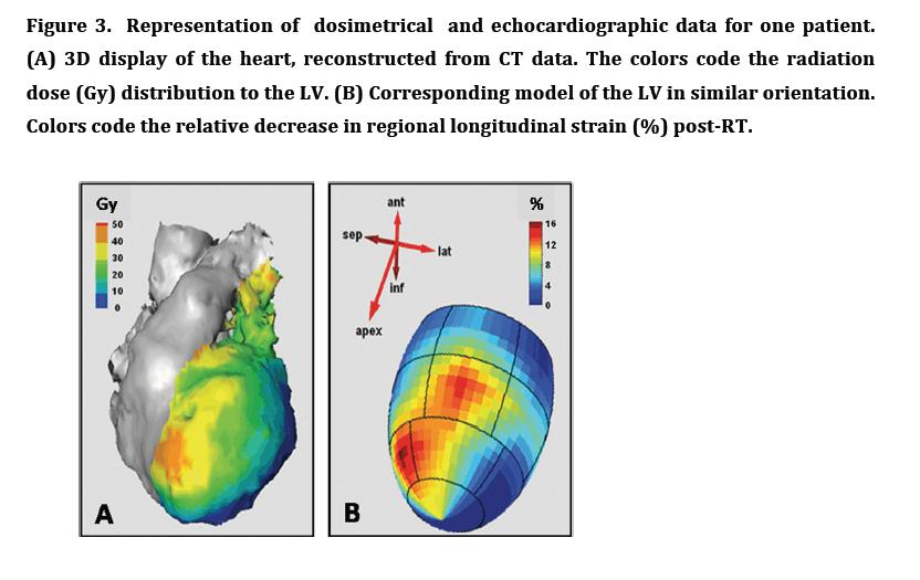 BORSTCA Strain rate imaging (SRI) Strain rate measures the speed at which relative length change of the myocardium occurs.
