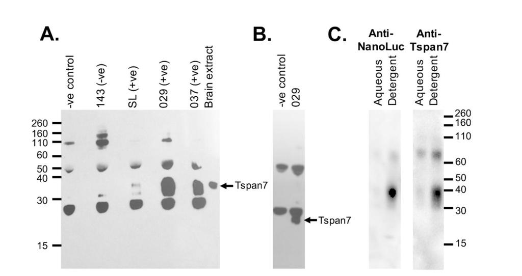 Immunoaffinity precipitatie van T span7 met diabetes sera Muis T-span7 werd gecloneerd en tot expressie gebracht in E.