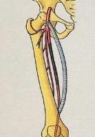 Onder algemene narcose (uitzonderlijk wordt een ruggenprik toegediend waarbij alleen de benen worden verdoofd) wordt via een insnede in de lies de beenslagader vrijgelegd boven de vernauwing.