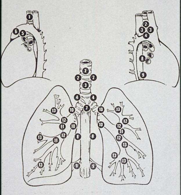 MEDIASTINOSCOPIE Anatomie PAS OP!