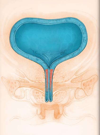 Behandeling Urge- Incontinentie Blaastraining 1,Anti-cholinergica ( + mirabegron =