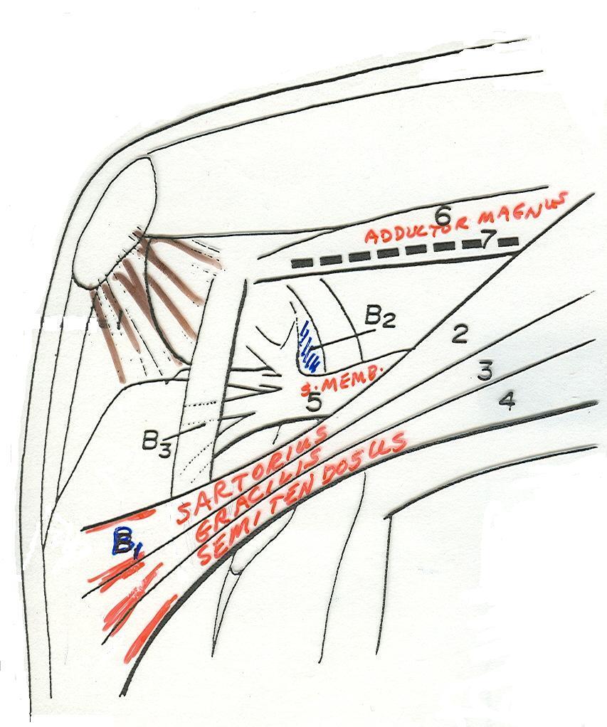 (tendinopathie