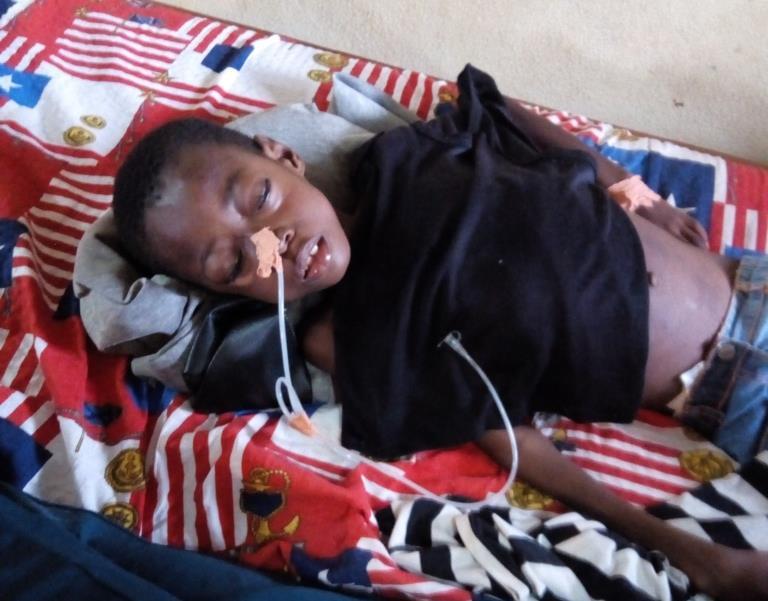 Etongwe Seth Een jongen van 7 jaar. Opgenomen in de General Hospital in Kumba met erge buikpijn, koorts en ondervoeding.