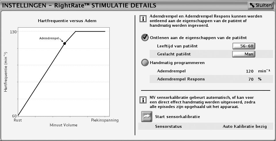 2-54 Stimulatietherapieën Frequentie Adapterende Stimulatie en Sensortrending Figuur 2 25.