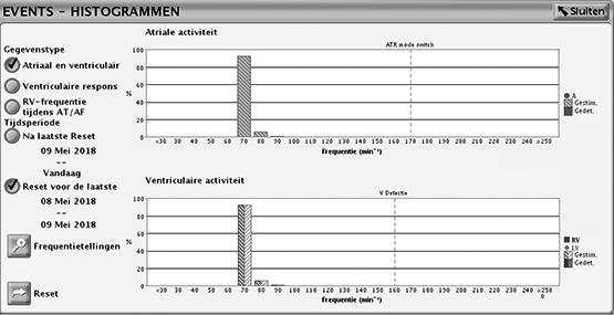 2-60 Stimulatietherapieën Frequentie Adapterende Stimulatie en Sensortrending Follow-up apparaatbeoordelingen na het programmeren van de MV sensor of accelerometer, kunnen parameters verbonden met de