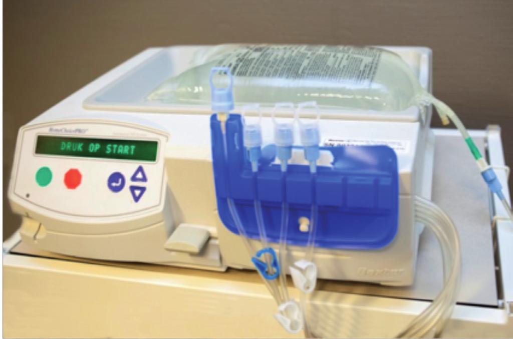APD APD APD staat voor Automatische Peritoneale Dialyse. Automatisch verwijst naar het feit dat hiervoor gebruik wordt gemaakt van een machine.