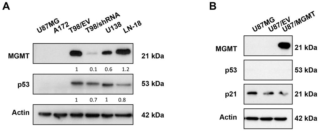 PRIMA-1 MET induces cytotoxic effects in GBM cell lines irrespective of p53 status We used PRIMA-1 MET to test the functional consequences of down-regulation of MGMT expression levels in our MGMT