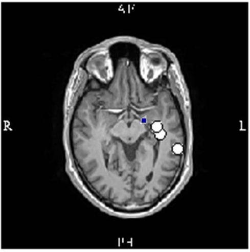 A B C Fig.17: A: axiale doorsnede.