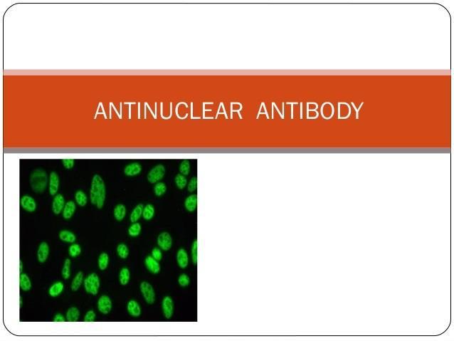 Systeemziekte en longfibrose Antinucleaire antistoffen (ANA) SLE 90% Systemische