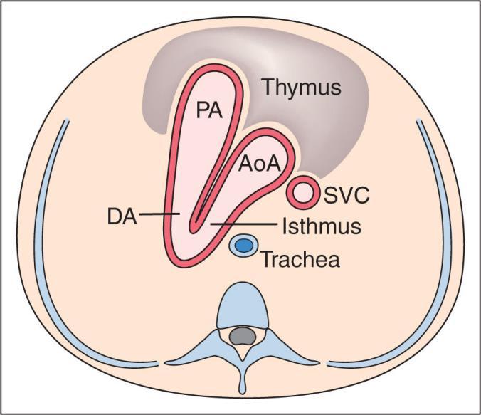 pulmonalis en aorta