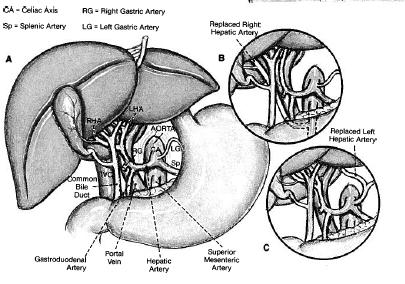 Aberante arteriële anatomie bovenbuik