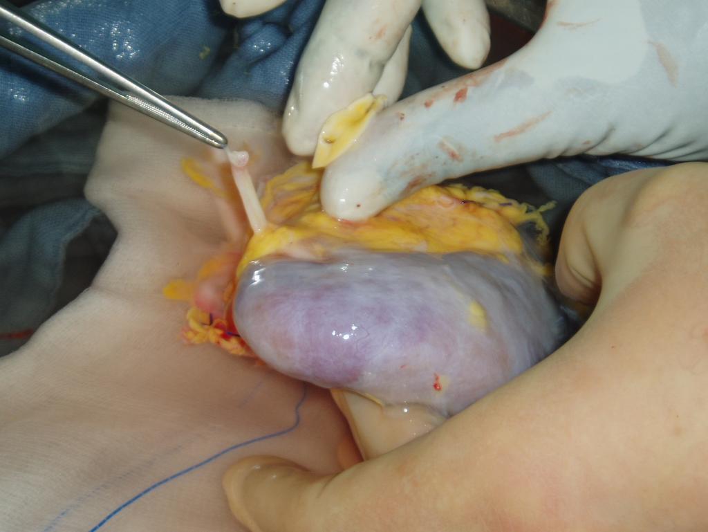 Inspectie van het orgaan: onvolledig