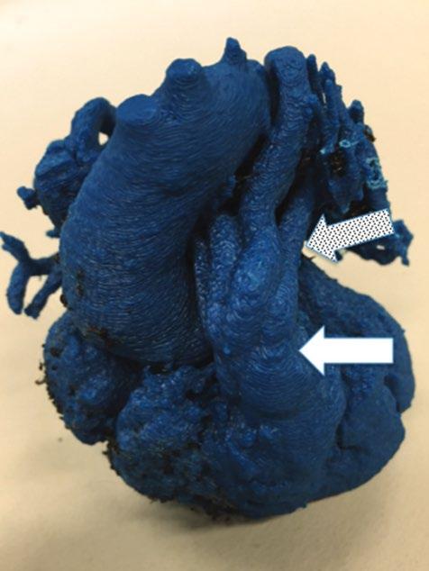 Instuderen anatomie From: 3D-Printing in Congenital Cardiology: From