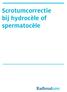 Scrotumcorrectie bij hydrocèle of spermatocèle