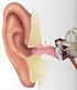 De ontsteking die zorgt voor het loopoor kan op verschillende plaatsen zitten: het middenoor, de gehoorgang of een operatiewond.