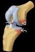 23-Oct-14. 6) Waardoor wordt hyperextensie van het kniegewricht vooral beperkt? A) Banden B) Bot C) Menisci D) Spieren