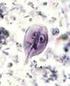 Giardia en giardiasis