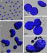 3-D Nuclear chromatin texture analysis using confocal laser scanning microscopy