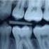 De herziene Richtlijn Tandheelkundige Radiologie