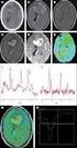 Kinderneurologie.eu. Gliomatosis cerebri.